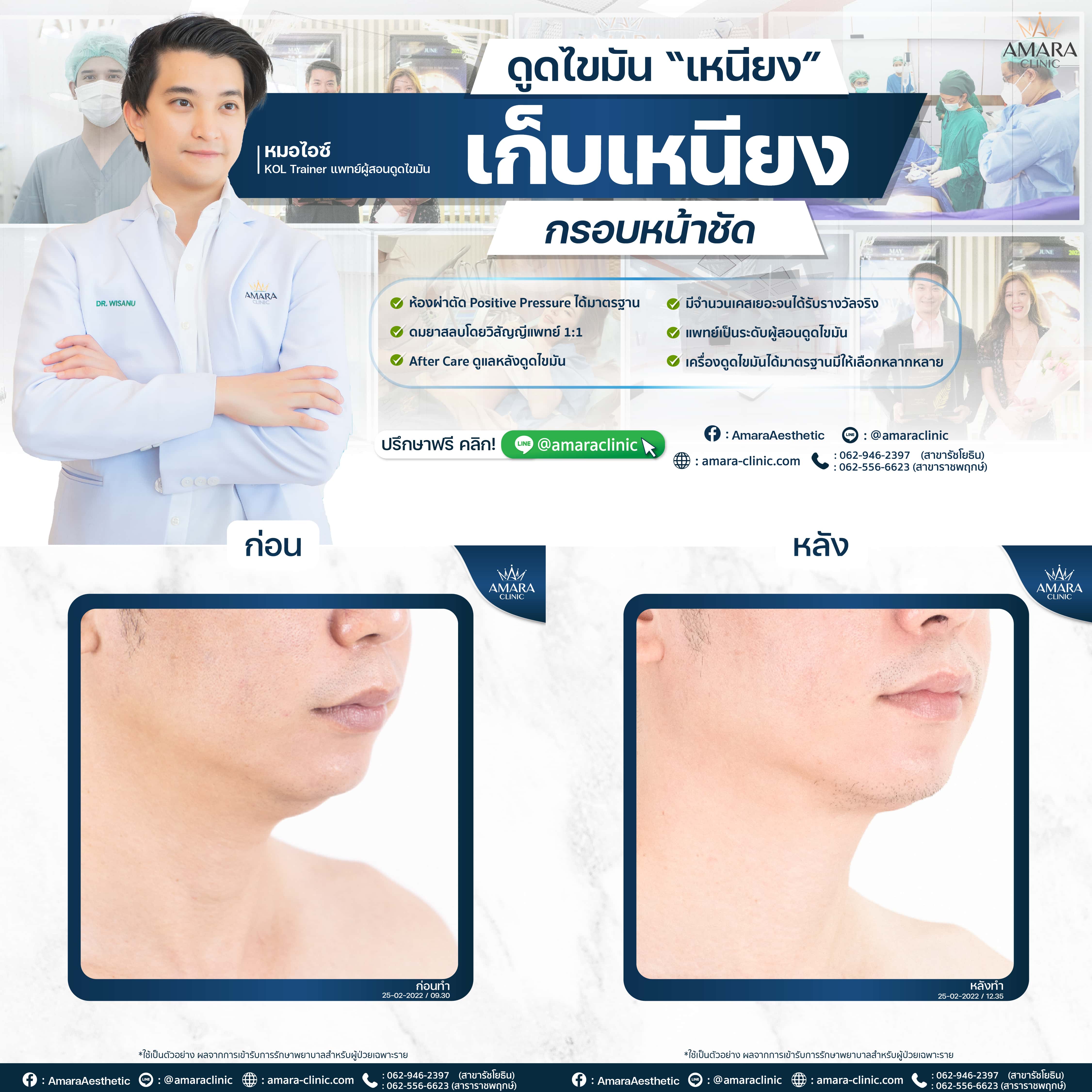 20220825-Aware-BA-Album 7244 -04