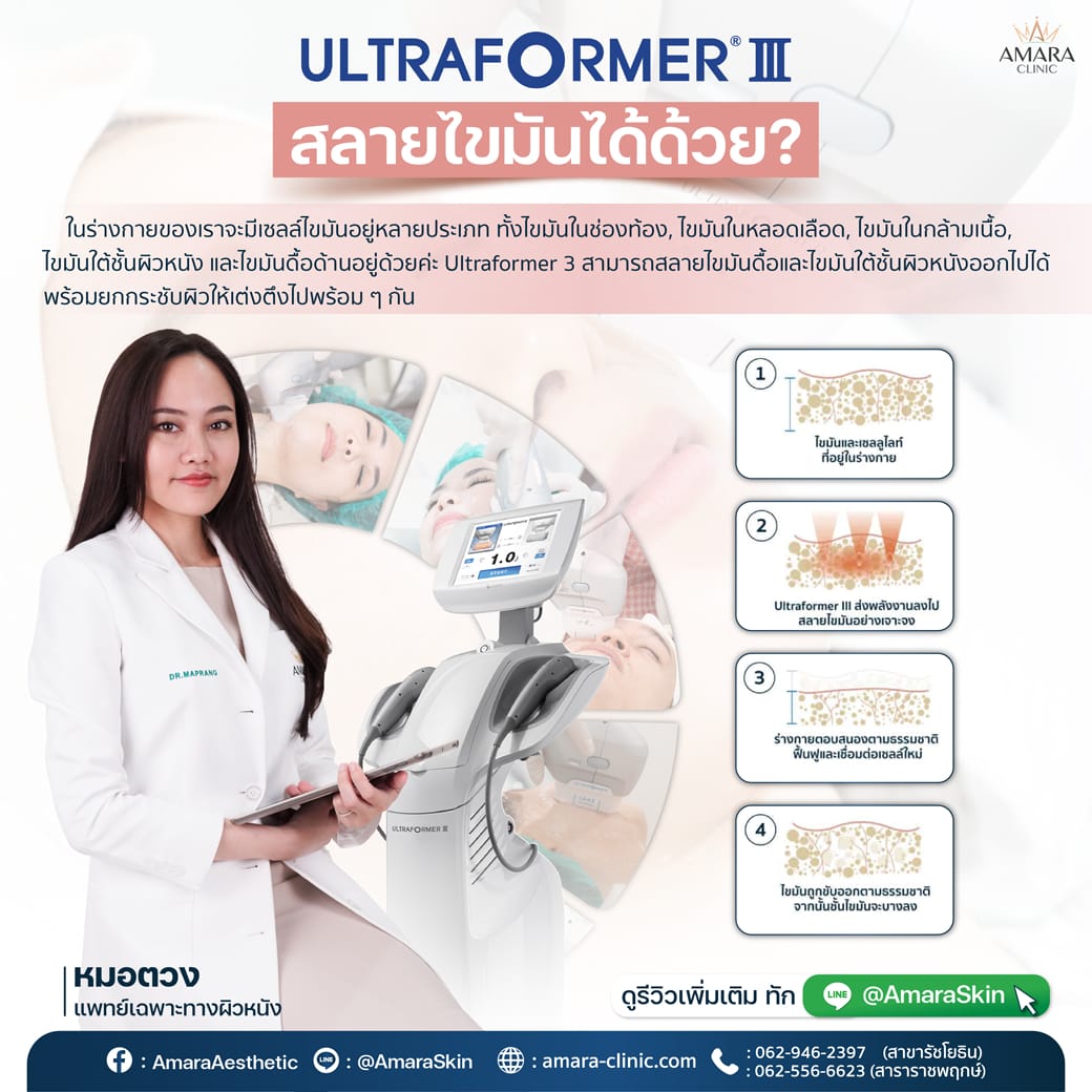 20221127-Consi-Single-MMFU Consi -01