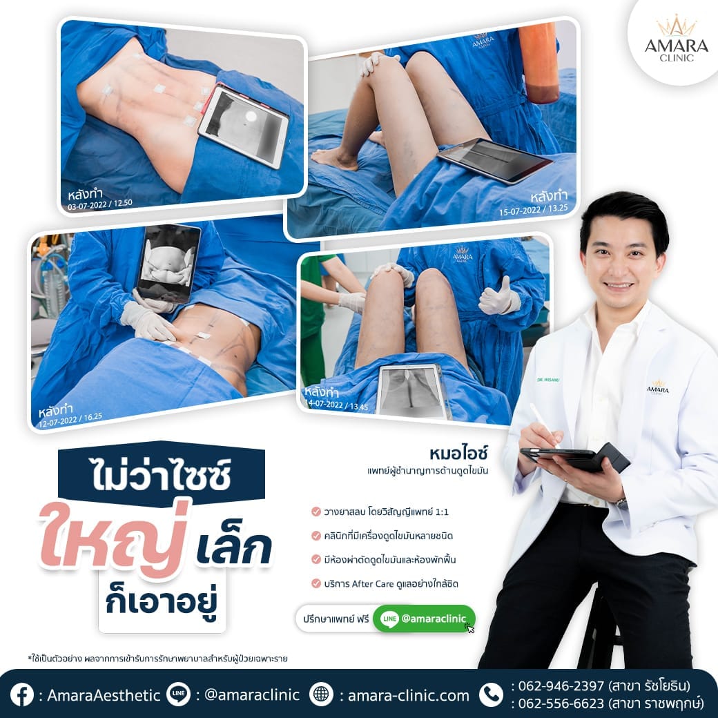 temp-20220721-Aware-2