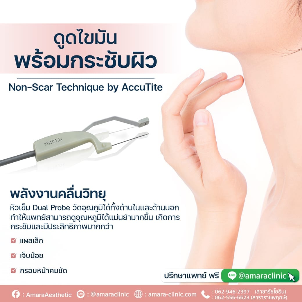 temp-20221117-Aware-single--01