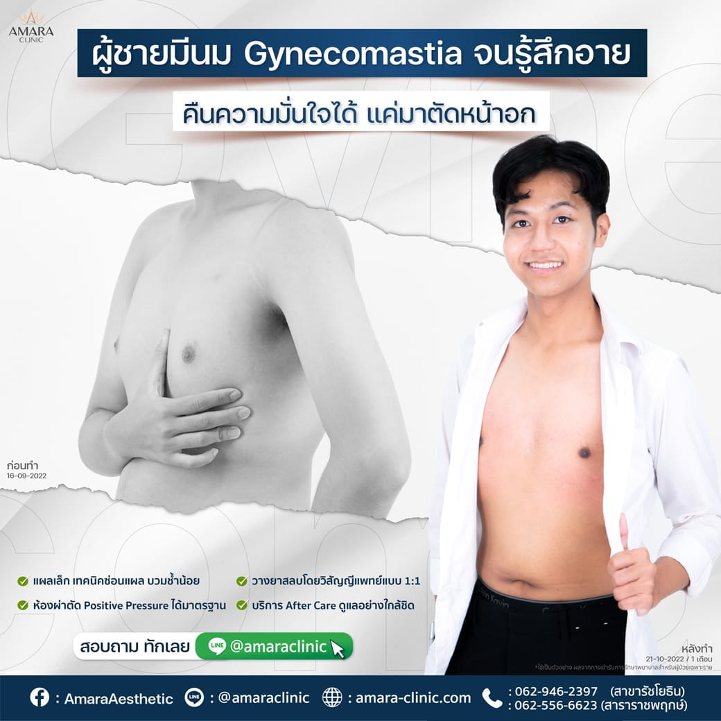 temp-20221206-Aware-Single-aware 7713-01