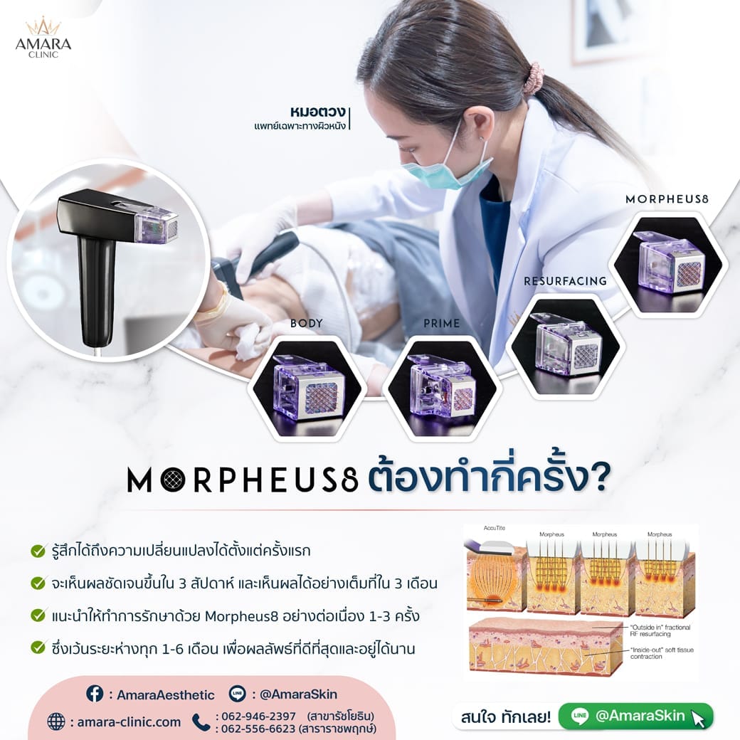 temp-20230111-Consi-Single-MP8 Consi Morpheus8 -01