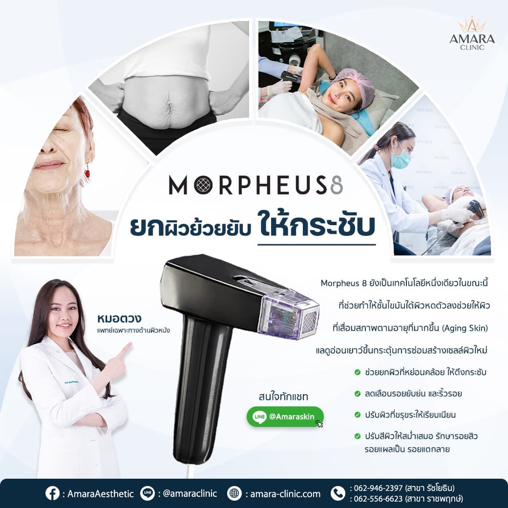 temp-20230114-Aware-Single-MP8