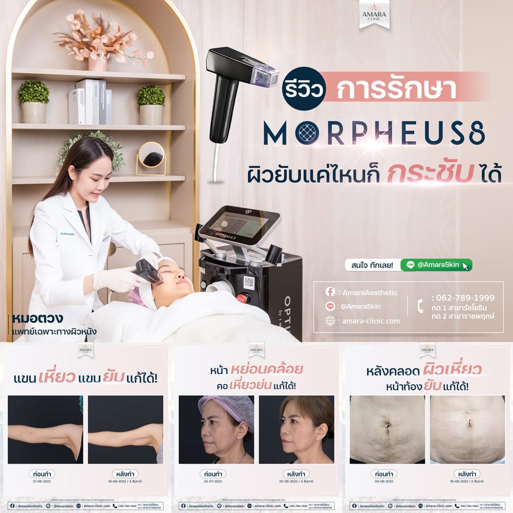 temp-20230427-Aware-Album-MP8 -07