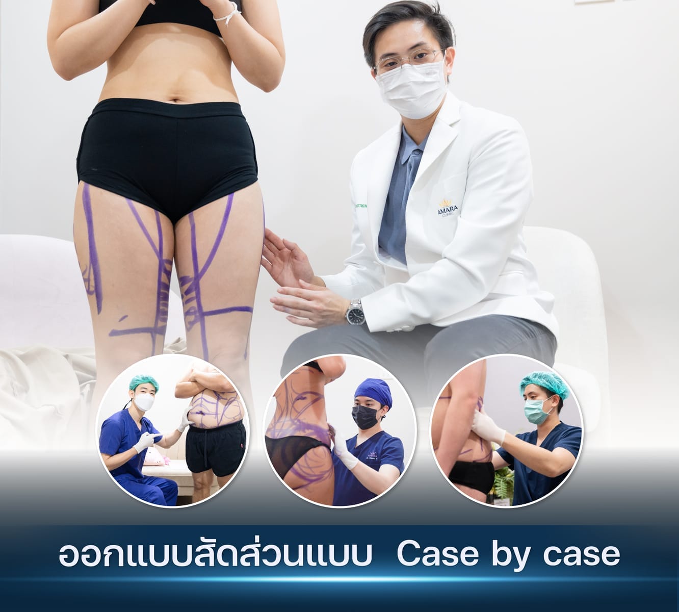 temp-20230503-Line Card-Album-2023-04-13 Balloon 3 card selling point-08