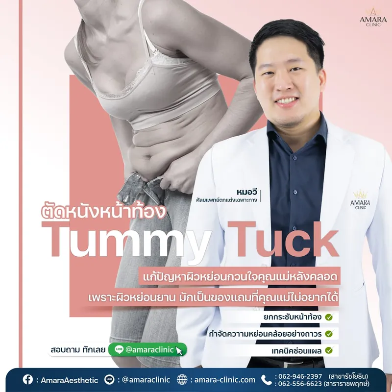 20221206-Aware-Single-aware tummy tuck-01